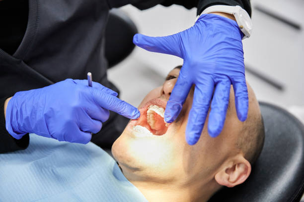 Best Emergency Treatment for Dental Infections or Abscesses in New Carlisle, OH