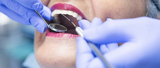 Best Emergency Treatment for Dental Infections or Abscesses in New Carlisle, OH
